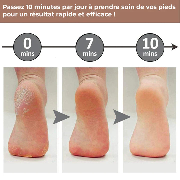 Lime électrique anti-callosité pour pied